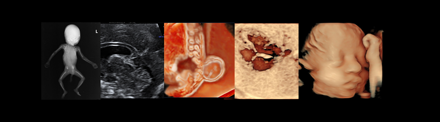 Banner image Banner image